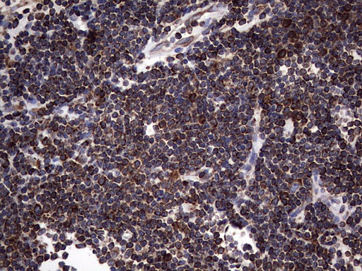 MTDH Antibody in Immunohistochemistry (Paraffin) (IHC (P))