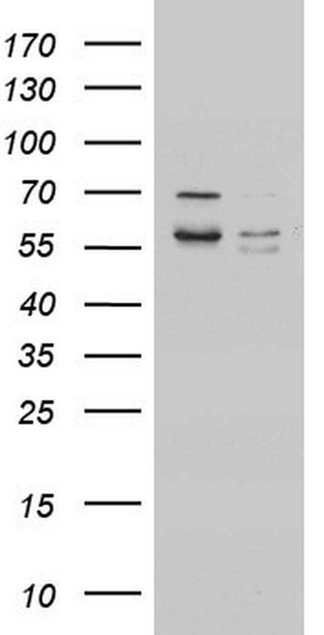 MTDH Antibody in Western Blot (WB)