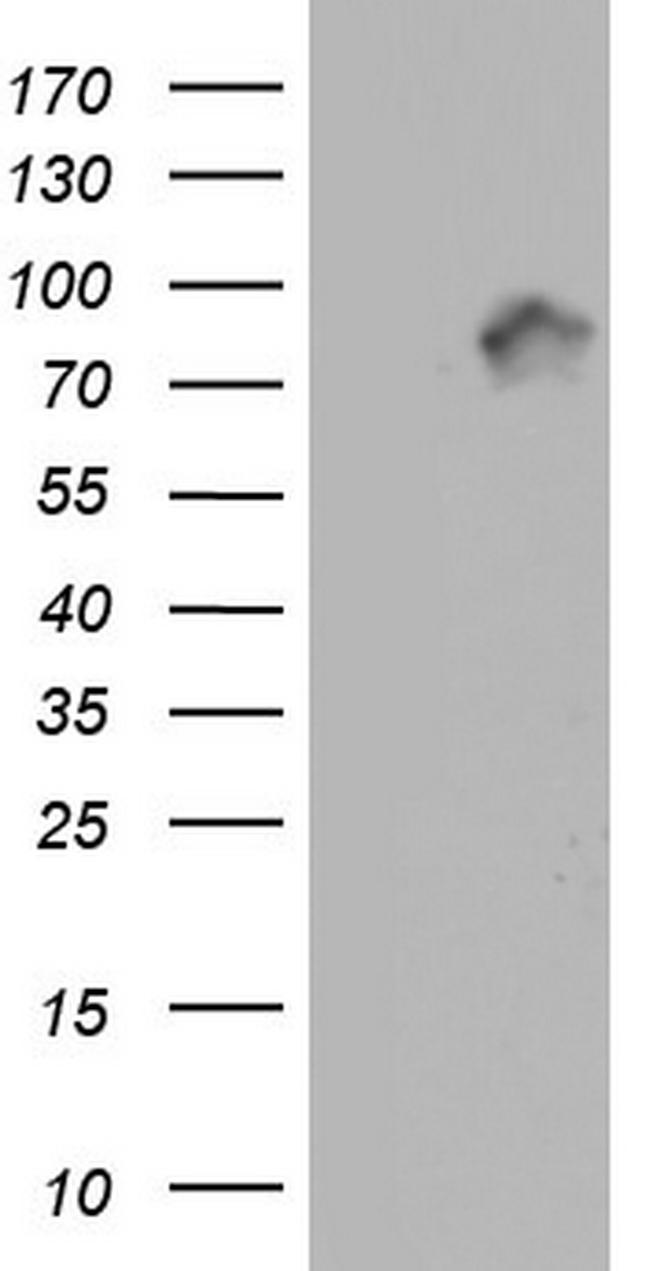 MTDH Antibody in Western Blot (WB)
