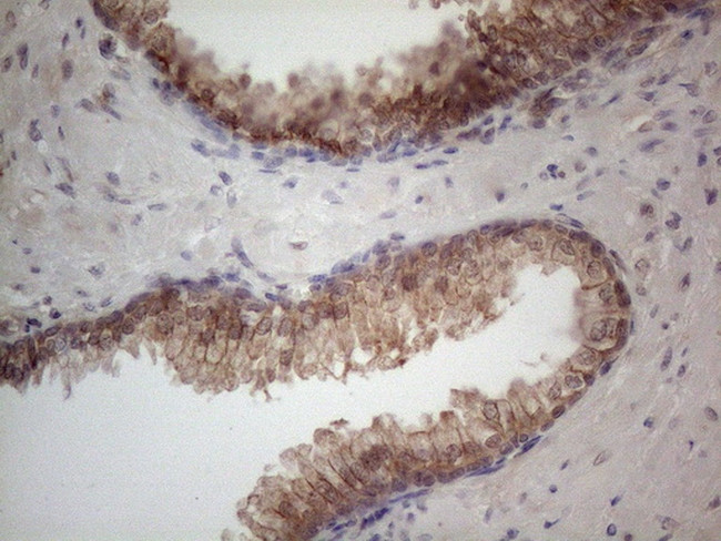 MTF1 Antibody in Immunohistochemistry (Paraffin) (IHC (P))