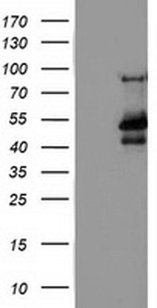 MTFMT Antibody in Western Blot (WB)