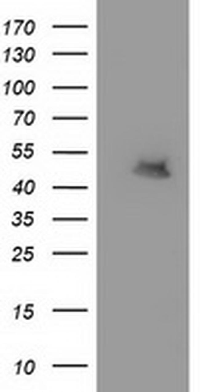 MTFMT Antibody in Western Blot (WB)