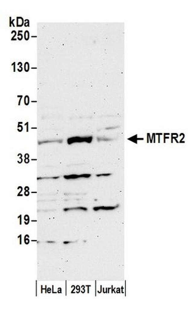 MTFR2 Antibody in Western Blot (WB)