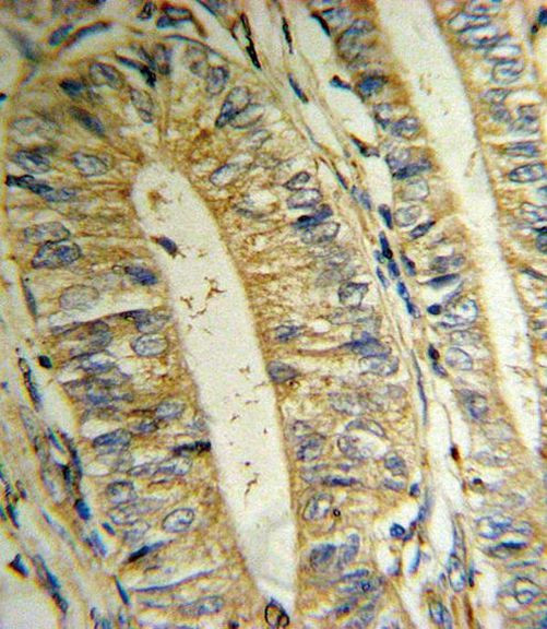 MTHFD2 Antibody in Immunohistochemistry (IHC)