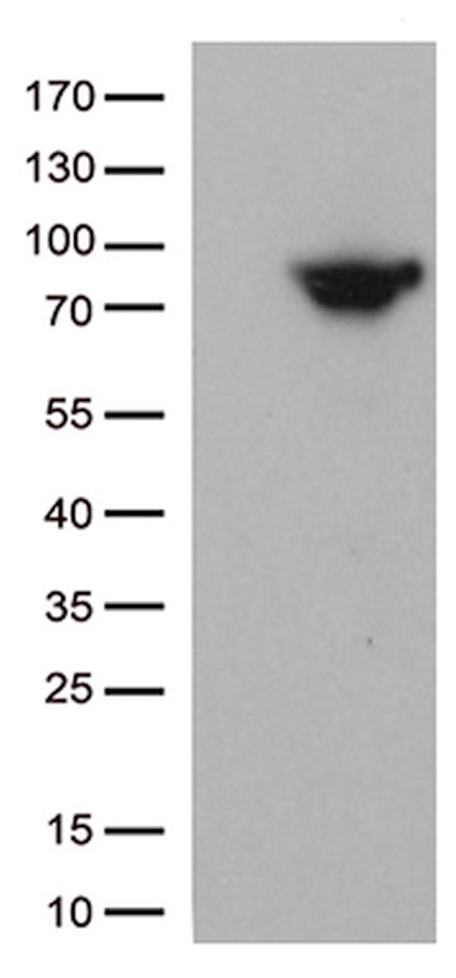 MTHFR Antibody in Western Blot (WB)