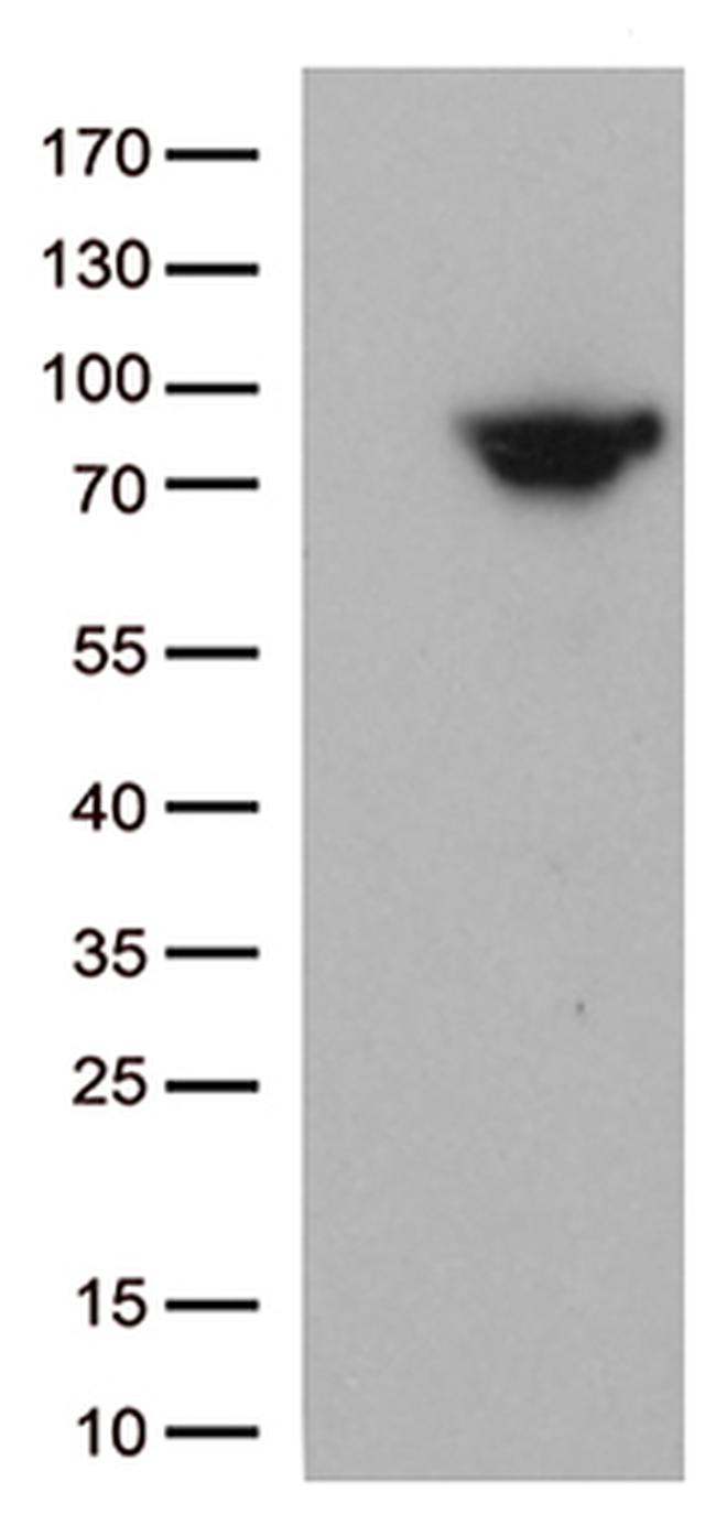 MTHFR Antibody in Western Blot (WB)