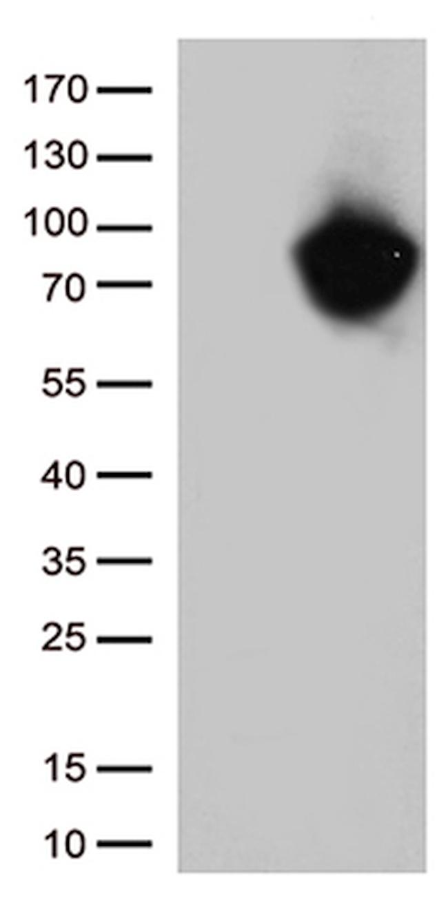 MTHFR Antibody in Western Blot (WB)