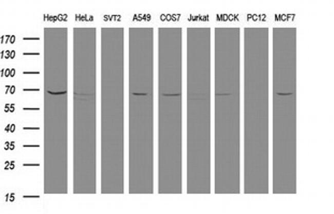 MTMR2 Antibody in Western Blot (WB)