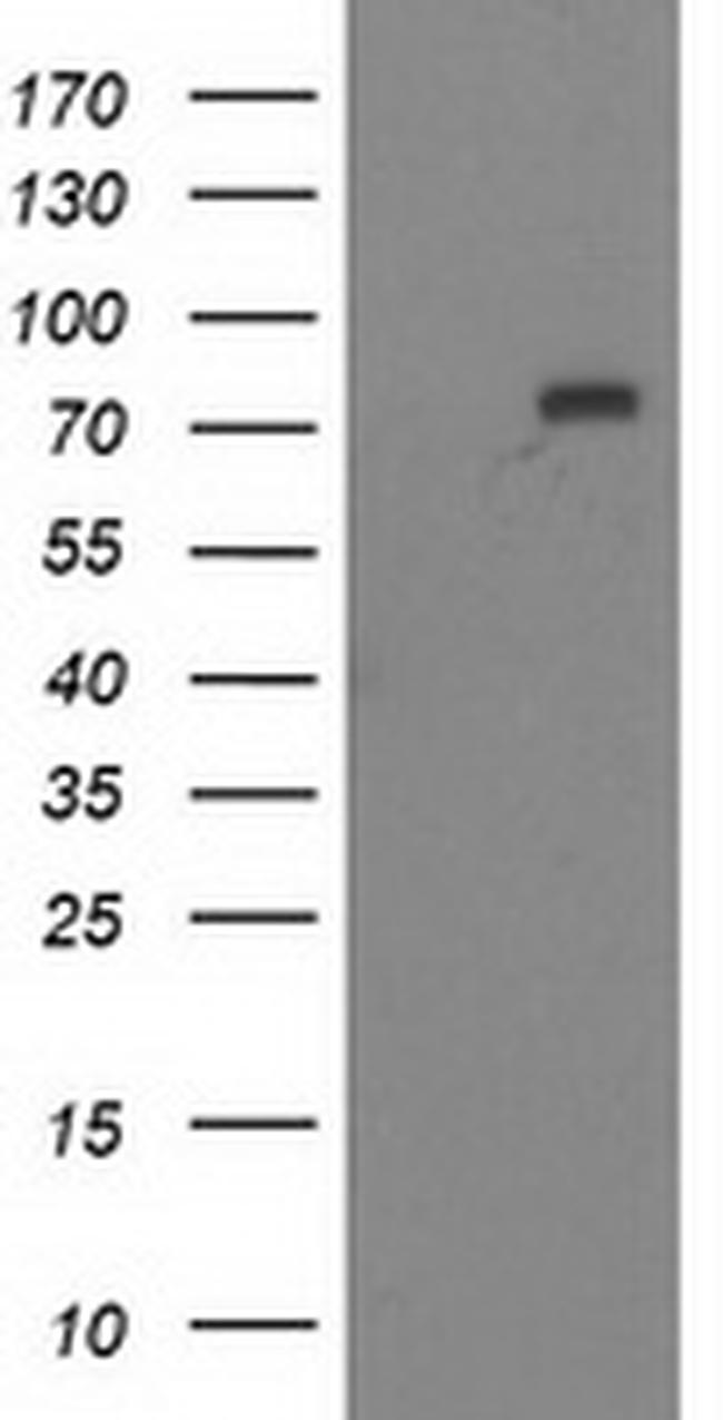 MTMR2 Antibody in Western Blot (WB)