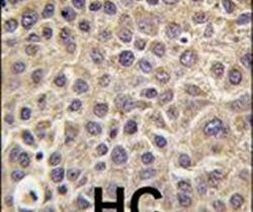 MTMR8 Antibody in Immunohistochemistry (IHC)