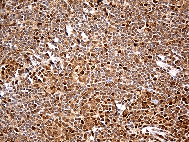 MTOR Antibody in Immunohistochemistry (Paraffin) (IHC (P))