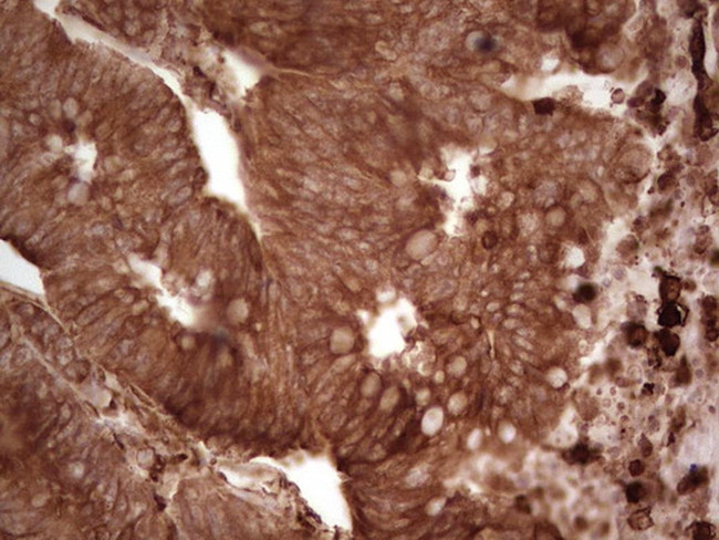 MTOR Antibody in Immunohistochemistry (Paraffin) (IHC (P))