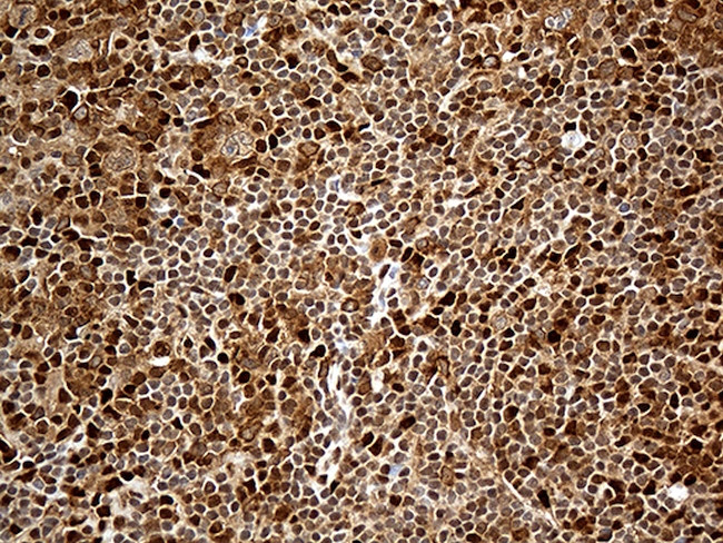 MTOR Antibody in Immunohistochemistry (Paraffin) (IHC (P))