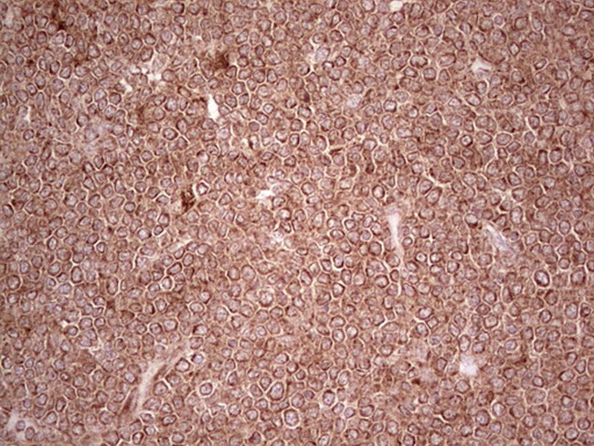 MTOR Antibody in Immunohistochemistry (Paraffin) (IHC (P))