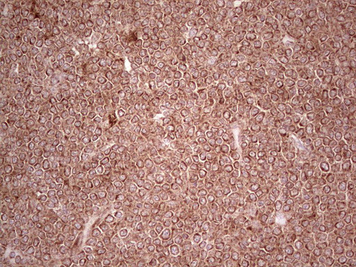 MTOR Antibody in Immunohistochemistry (Paraffin) (IHC (P))
