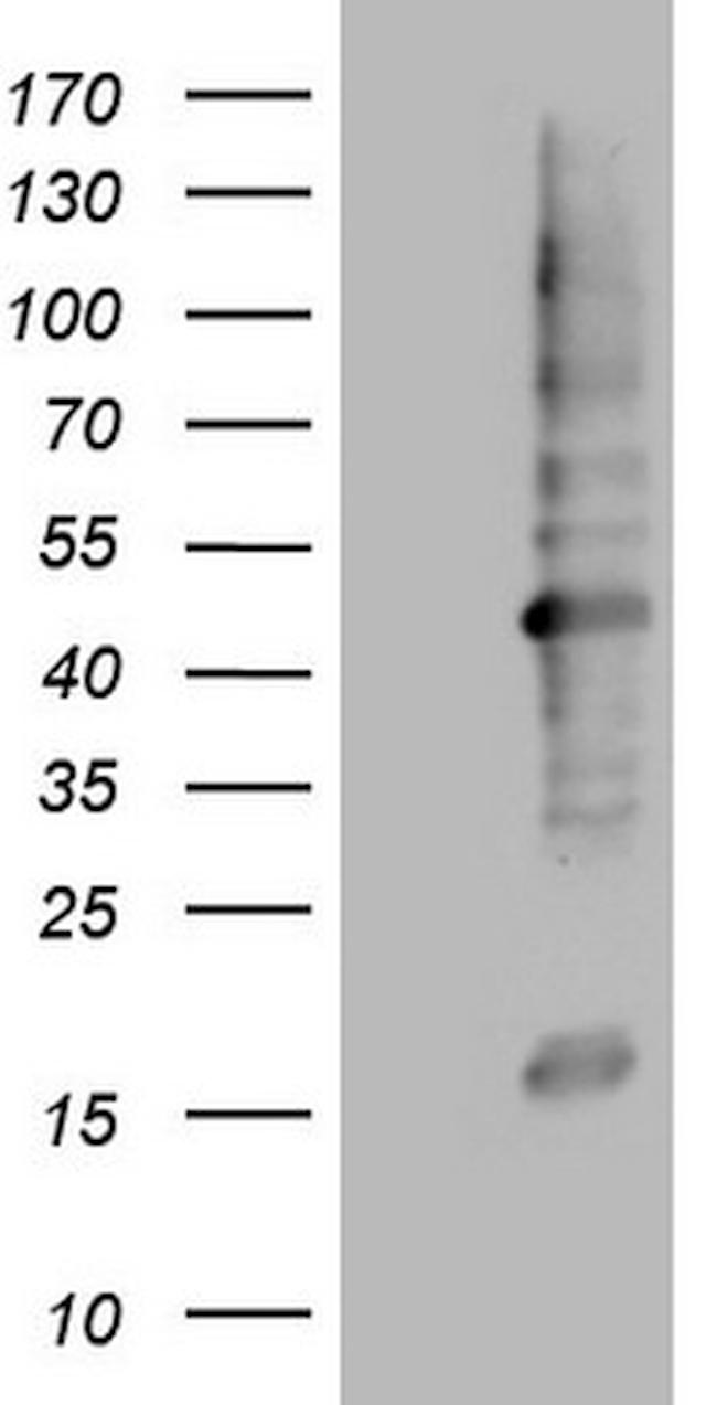 MTOR Antibody in Western Blot (WB)