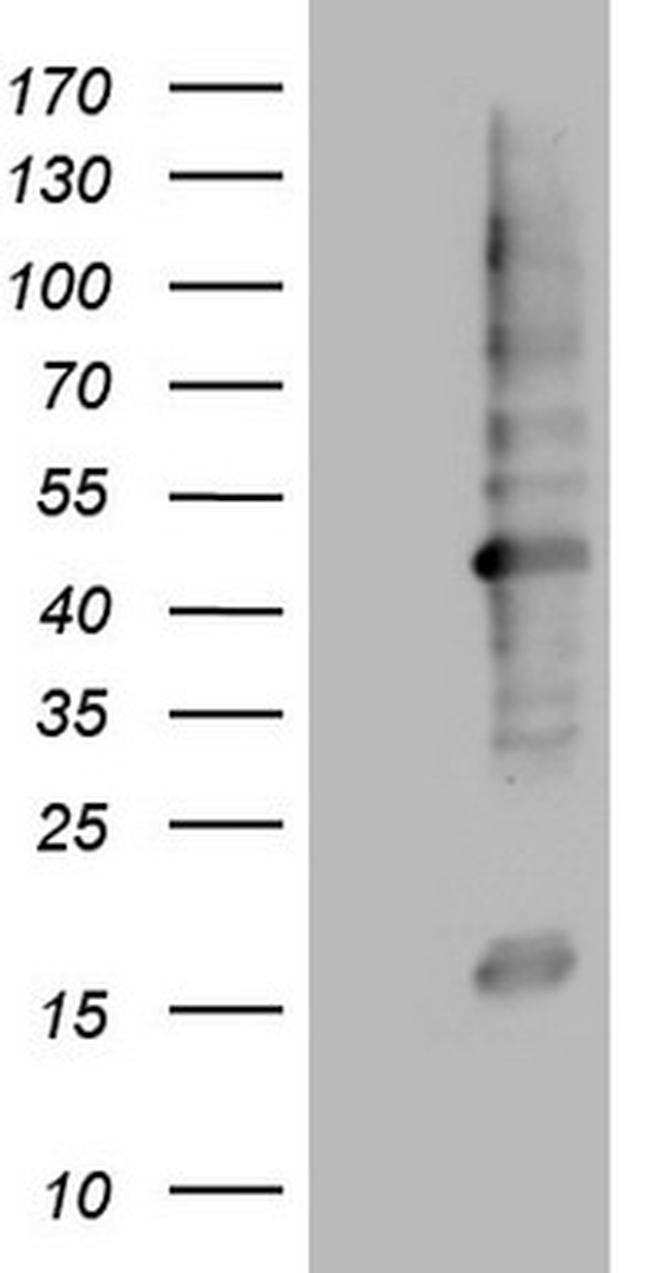 MTOR Antibody in Western Blot (WB)