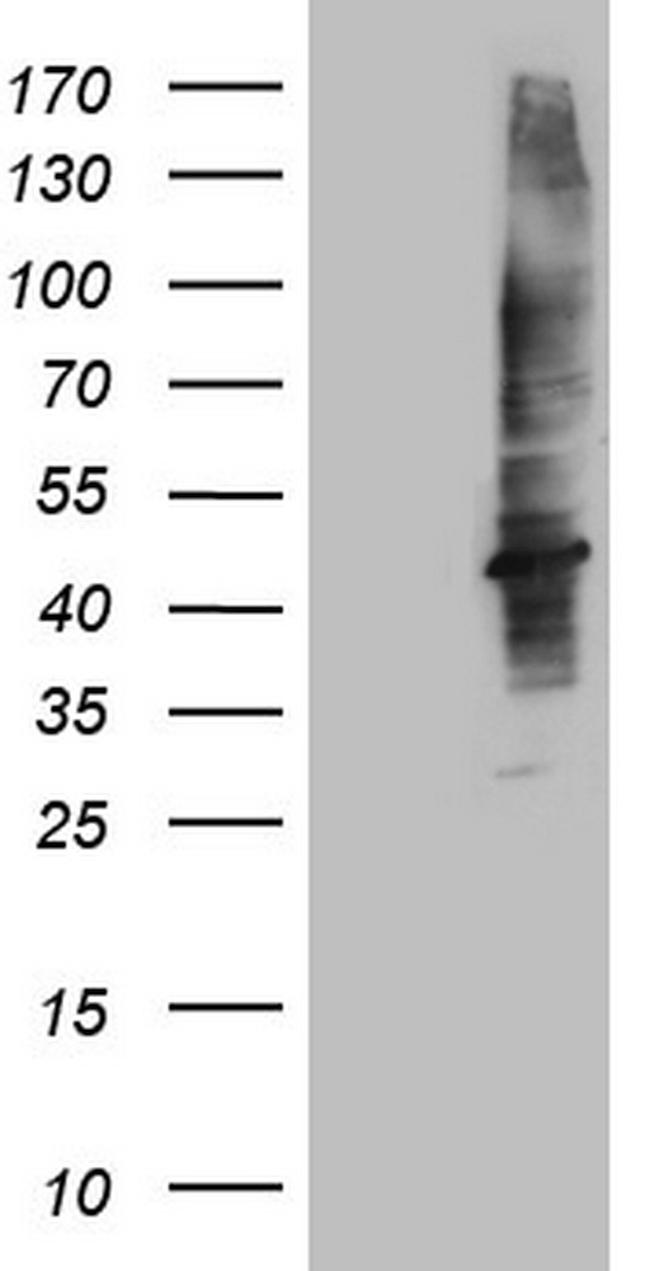 MTOR Antibody in Western Blot (WB)
