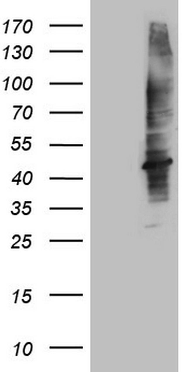 MTOR Antibody in Western Blot (WB)