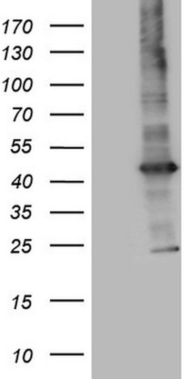 MTOR Antibody in Western Blot (WB)