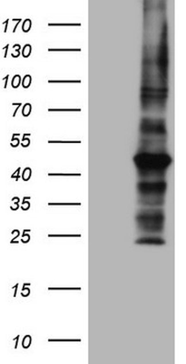 MTOR Antibody in Western Blot (WB)