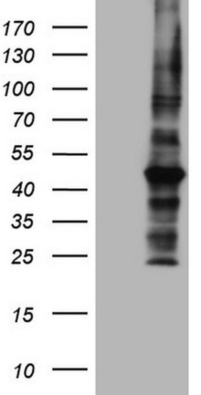MTOR Antibody in Western Blot (WB)