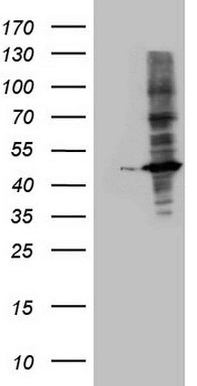 MTOR Antibody in Western Blot (WB)