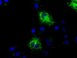 MTRF1L Antibody in Immunocytochemistry (ICC/IF)
