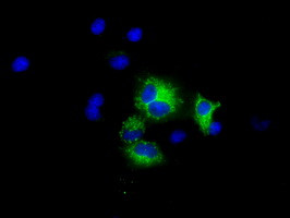 MTRF1L Antibody in Immunocytochemistry (ICC/IF)