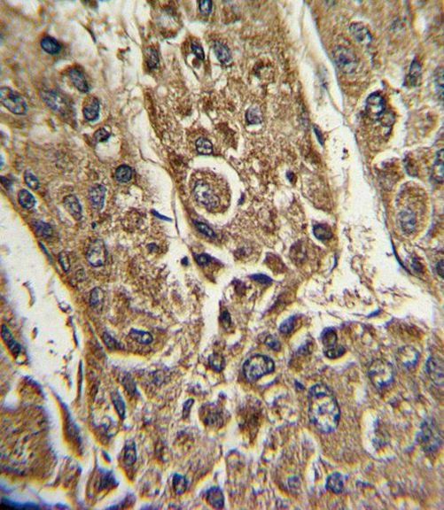 MTTP Antibody in Immunohistochemistry (IHC)