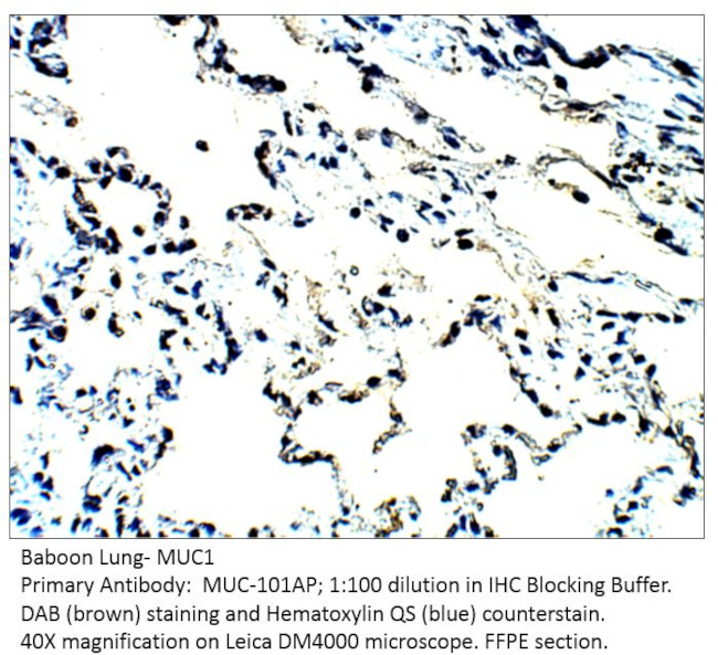 MUC1 Antibody in Immunohistochemistry (IHC)