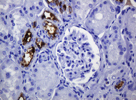 MUC1 Antibody in Immunohistochemistry (Paraffin) (IHC (P))