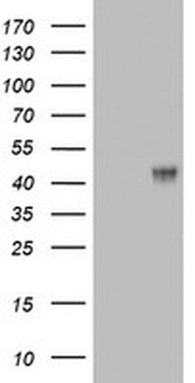 MUC1 Antibody in Western Blot (WB)