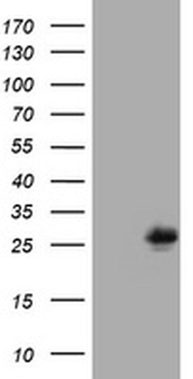 MUC1 Antibody in Western Blot (WB)