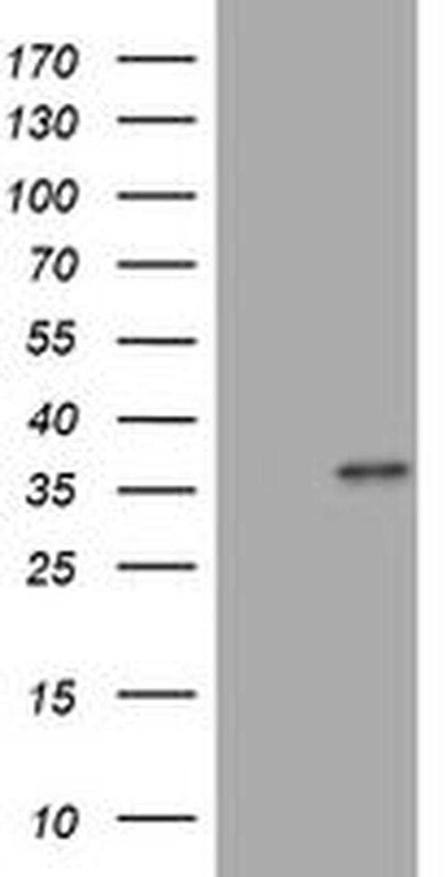 MUC16 Antibody in Western Blot (WB)