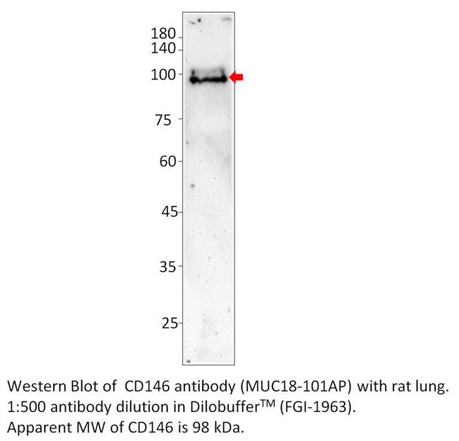 CD146 Antibody in Western Blot (WB)
