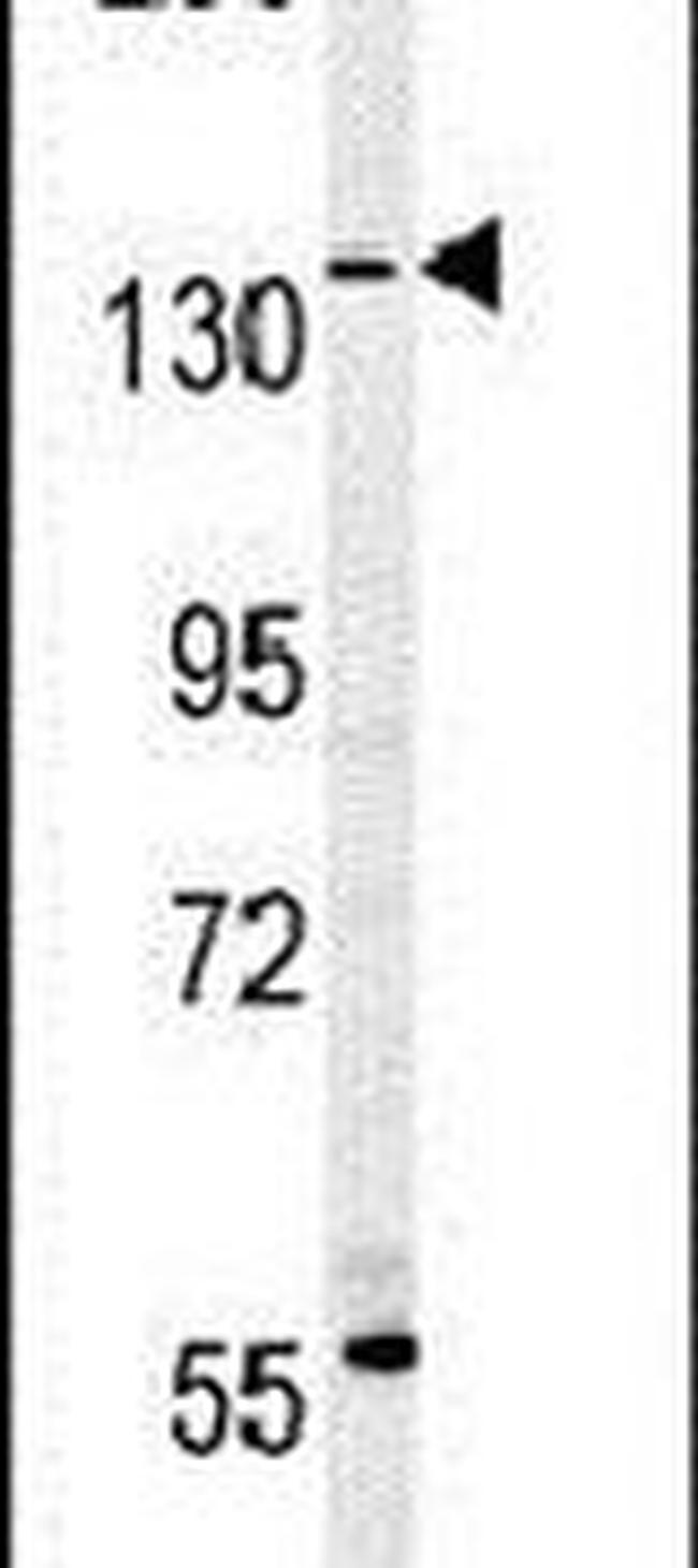 MUC1 Antibody in Western Blot (WB)