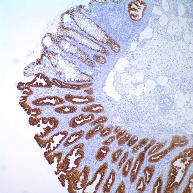 MUC2 Antibody in Immunohistochemistry (IHC)