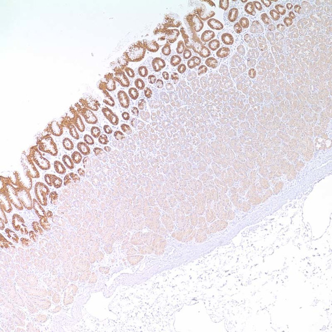 MUC5AC Antibody in Immunohistochemistry (IHC)
