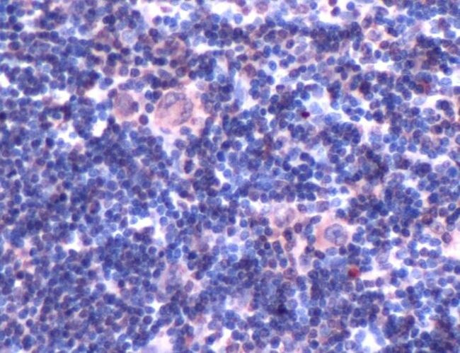 IRF4 Antibody in Immunohistochemistry (IHC)
