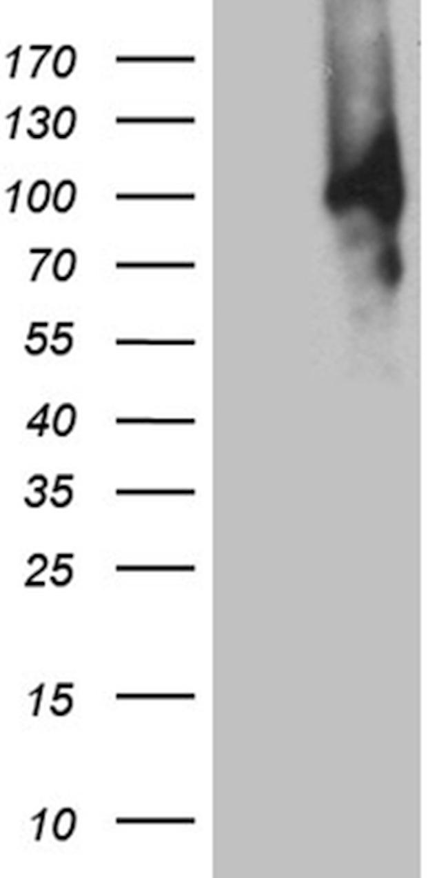 MUM1 Antibody in Western Blot (WB)