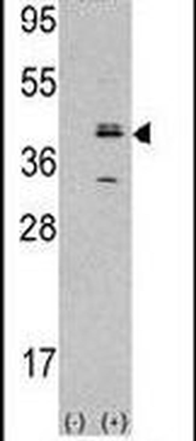MVK Antibody in Western Blot (WB)