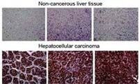 MYADM Antibody in Immunohistochemistry (Paraffin) (IHC (P))