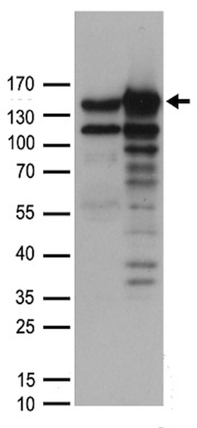 MYBBP1A Antibody in Western Blot (WB)