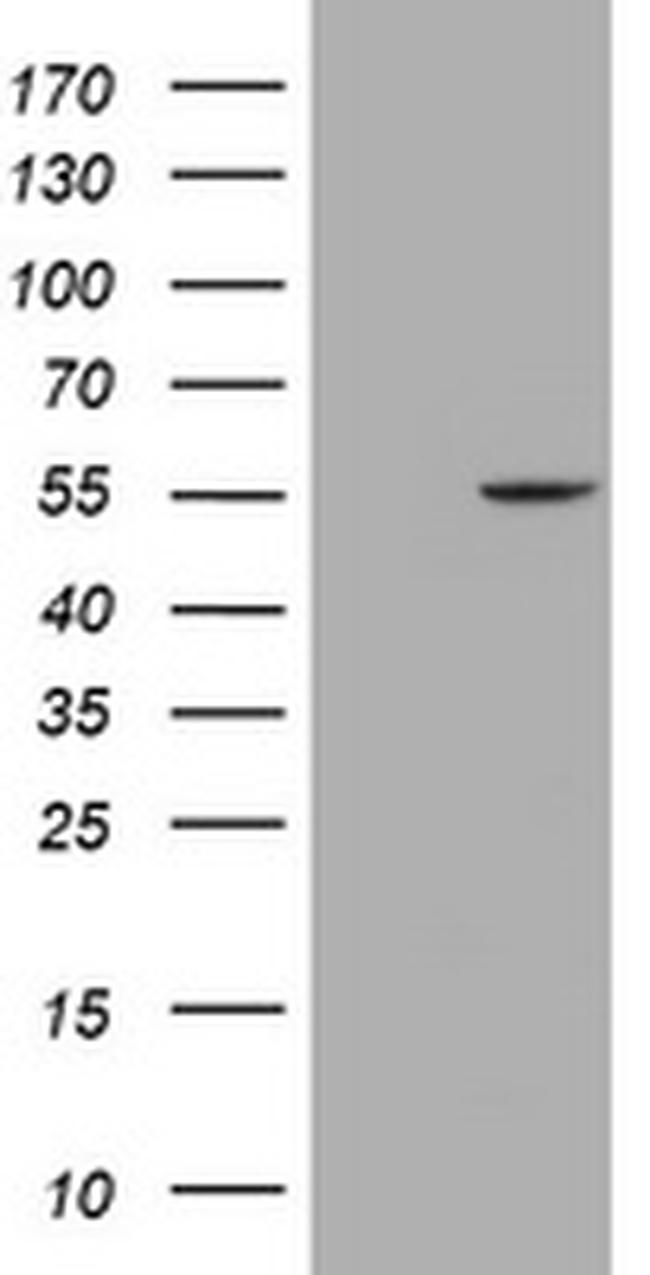 MYBPH Antibody in Western Blot (WB)