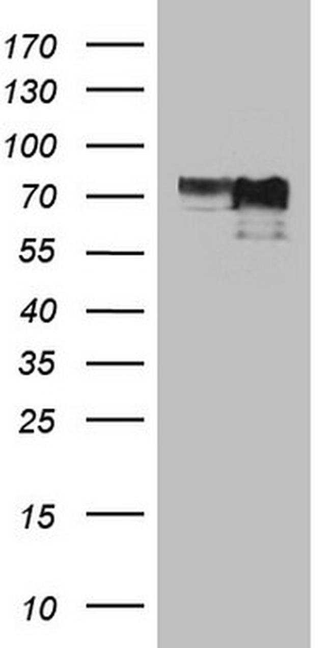 MYCN Antibody in Western Blot (WB)