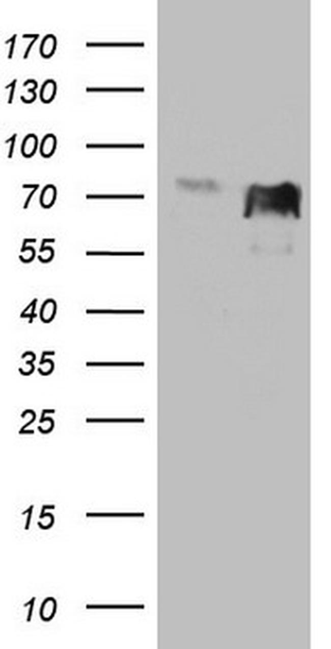 MYCN Antibody in Western Blot (WB)