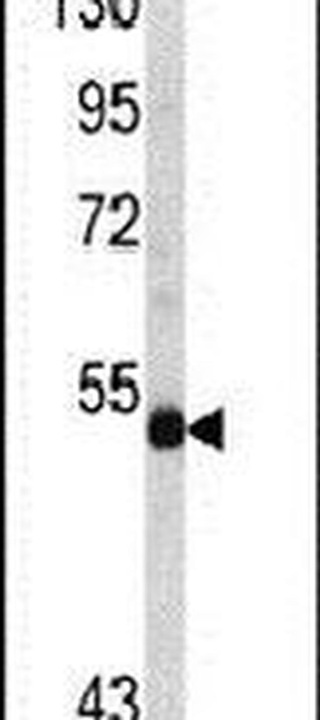 n-Myc Antibody in Western Blot (WB)