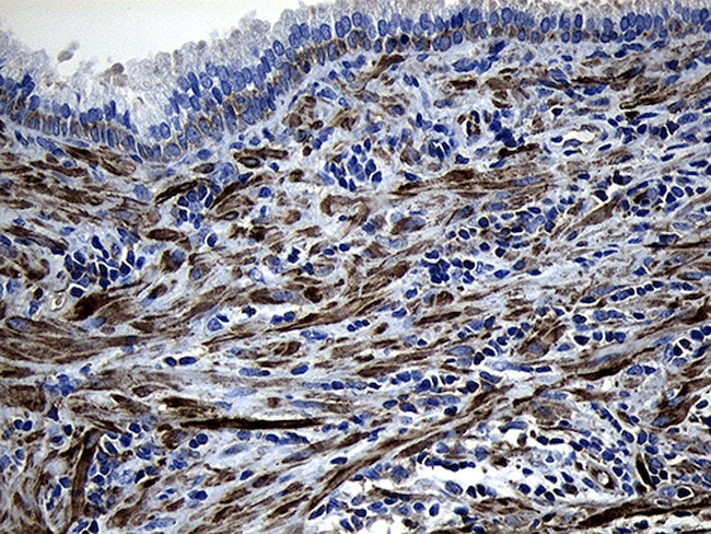 MYL1 Antibody in Immunohistochemistry (Paraffin) (IHC (P))
