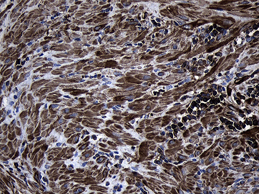 MYL1 Antibody in Immunohistochemistry (Paraffin) (IHC (P))